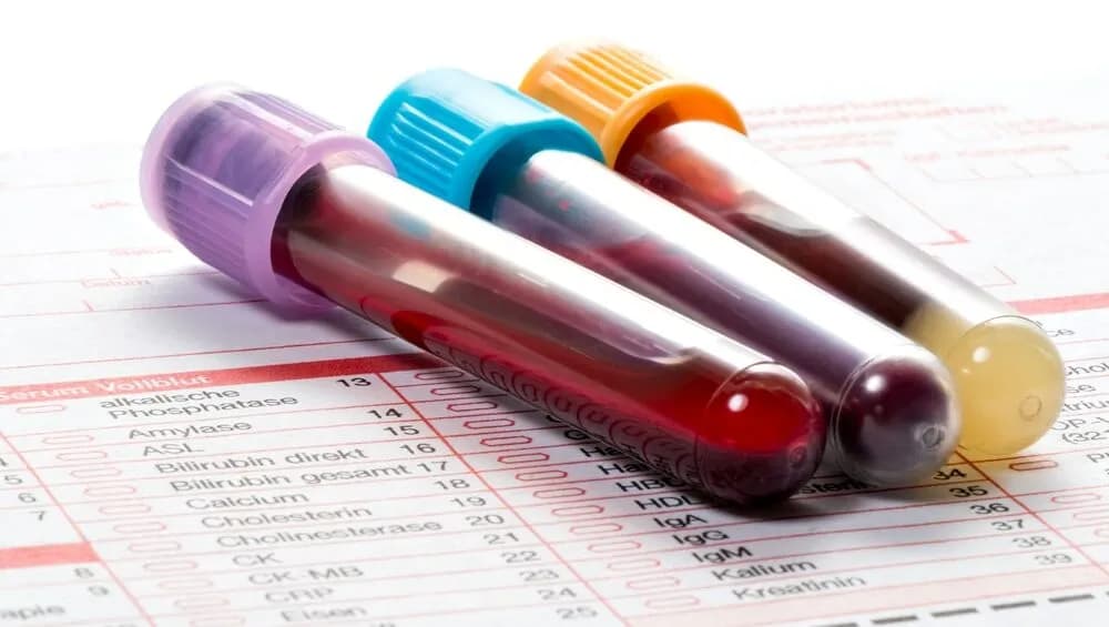 Podwyższony poziom androstendionu: objawy, przyczyny i skutki zdrowotne