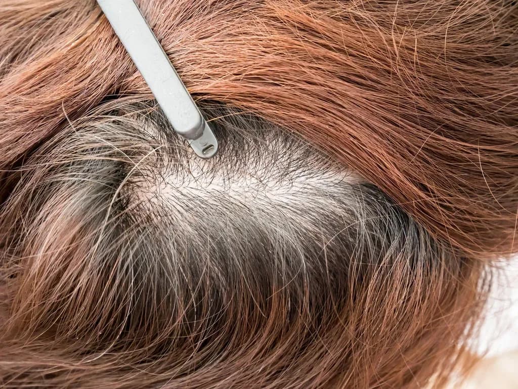 Jak zapobiec siwieniu włosów: skuteczne metody i porady na dłużej