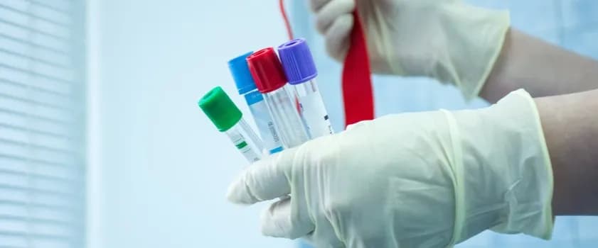 Czy badania hormonalne są na NFZ? Sprawdź, co musisz wiedzieć