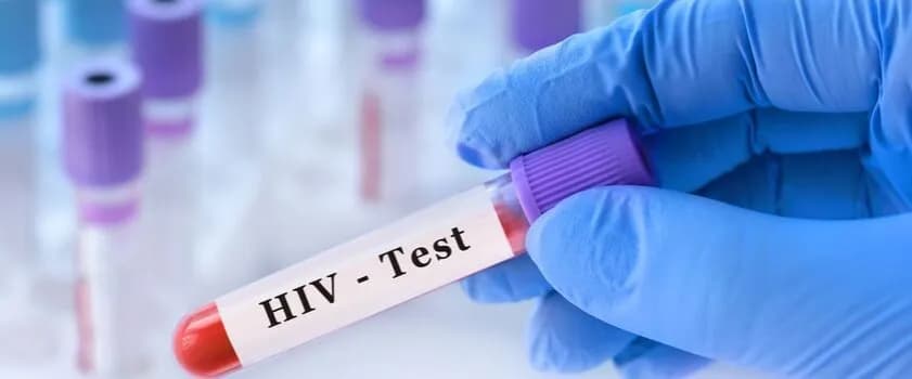 Ile kosztuje test na HIV w laboratorium? Ceny w różnych miastach