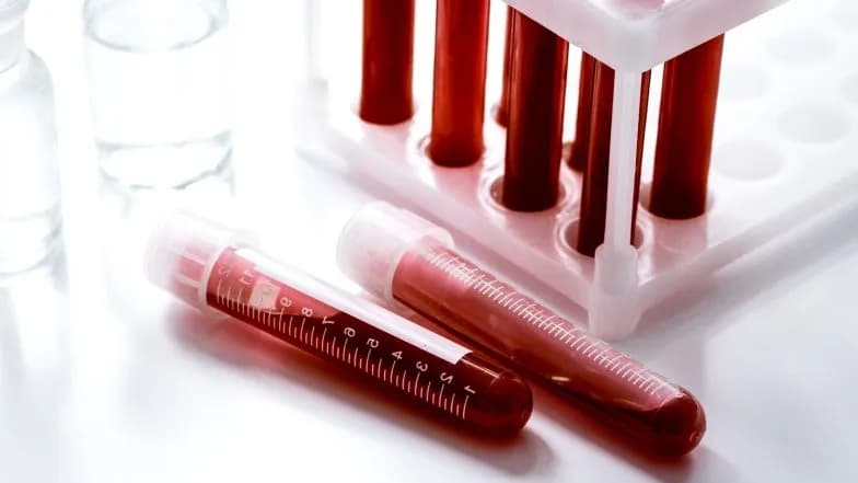 Podwyższony poziom erytrocytów: przyczyny, objawy i kiedy do lekarza